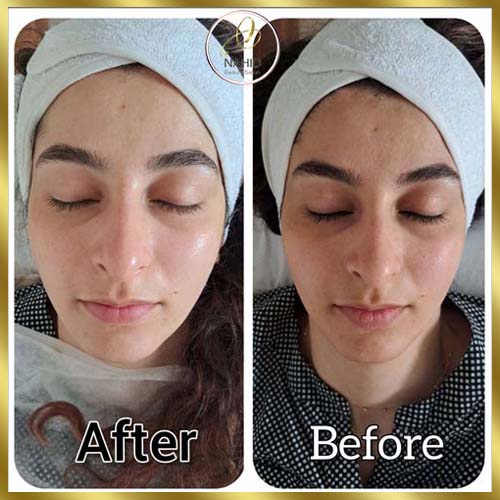 گالری پاکسازی پوست